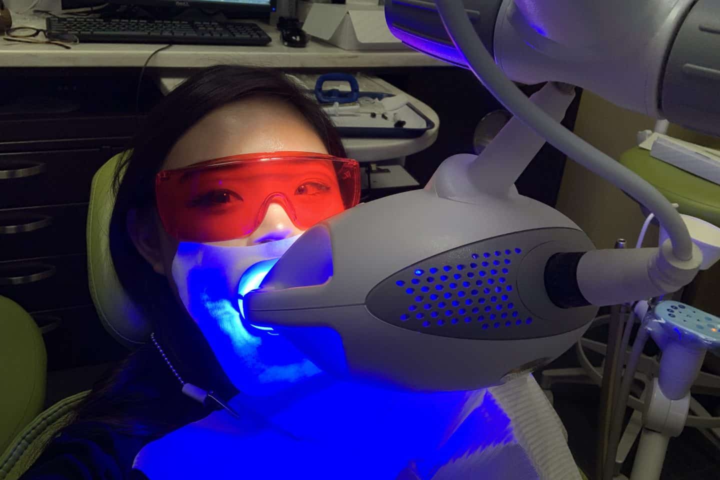 A review of the Philips Zoom teeth whitening procedure, including everything you need to know before and after getting it done!